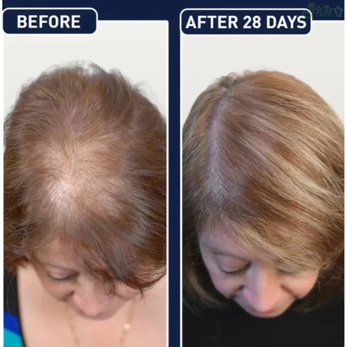 FEG Plus Hair Growth Spray