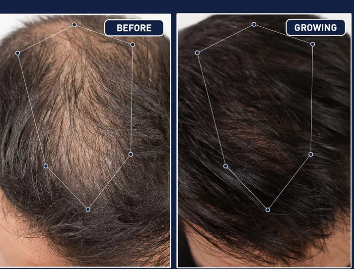 FEG Plus Hair Growth Spray