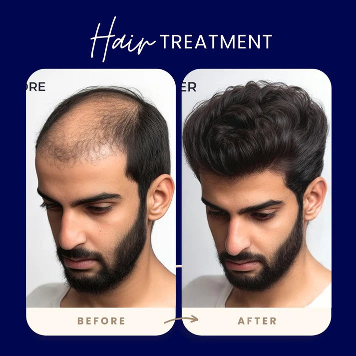 FEG Plus Hair Growth Spray