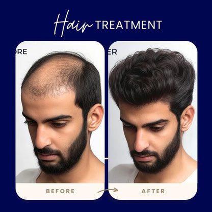 FEG Plus Hair Growth Spray